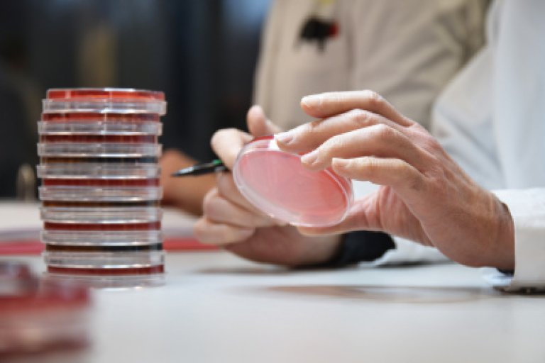 Bakteriologisk prøver og obduksjonsmateriale på forskjellige dyrkingsmedier i såkalte petriskåler. Blodskål.